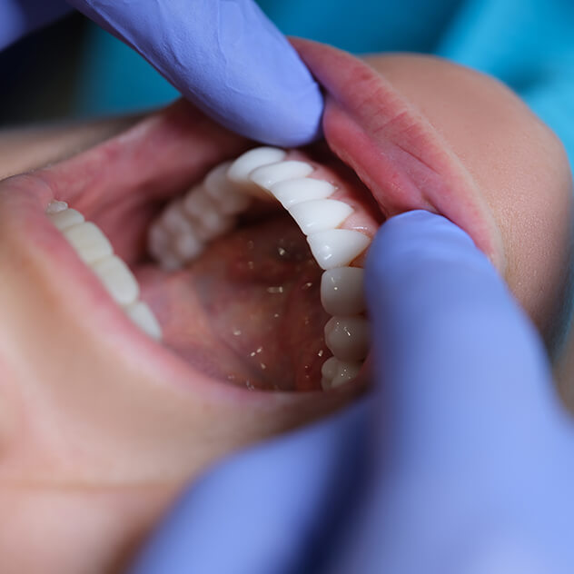 What is
oral surgery?